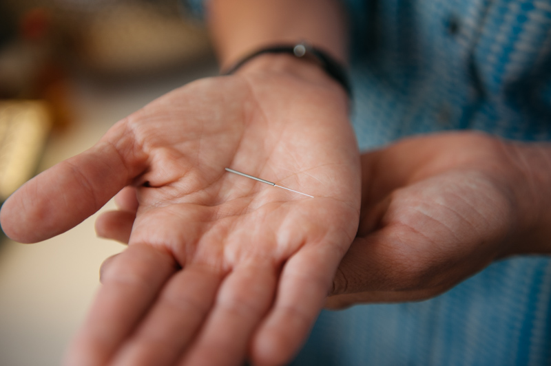  Acupuncture uses needles to access the body's 